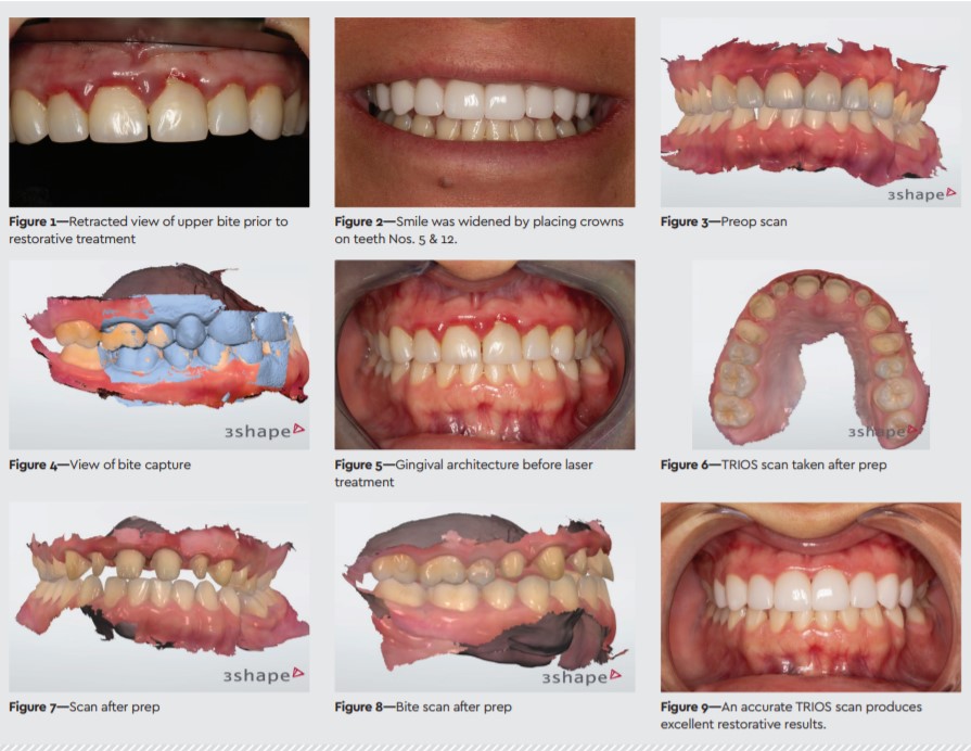 trios4 case presentation